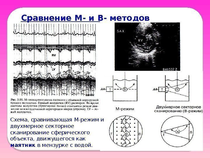 Сравнение M- и B- методов Схема, сравнивающая M-режим и двухмерное секторное сканирование сферического объекта,