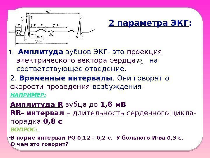 2 параметра ЭКГ : 1.  Амплитуда зубцов ЭКГ- это проекция электрического вектора сердца