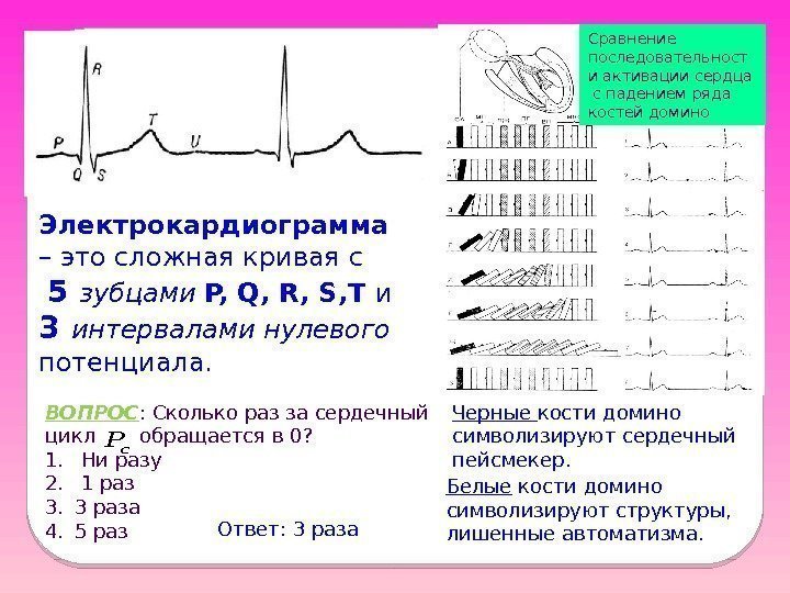 Электрокардиограмма  – это сложная кривая с  5 зубцами  P, Q, R,