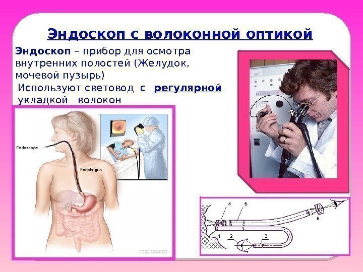 Эндоскоп с волоконной оптикой Эндоскоп – прибор для осмотра внутренних полостей (Желудок,  мочевой