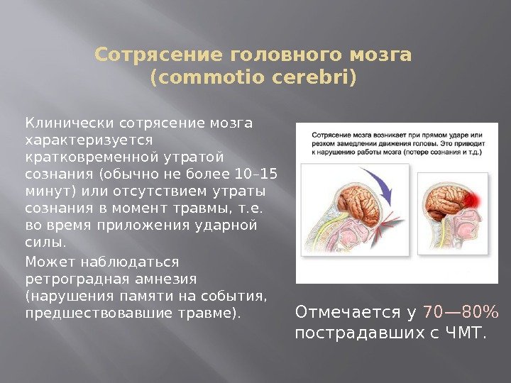 Сотрясение головного мозга (commotio cerebri) Клинически сотрясение мозга характеризуется кратковременной утратой сознания (обычно не