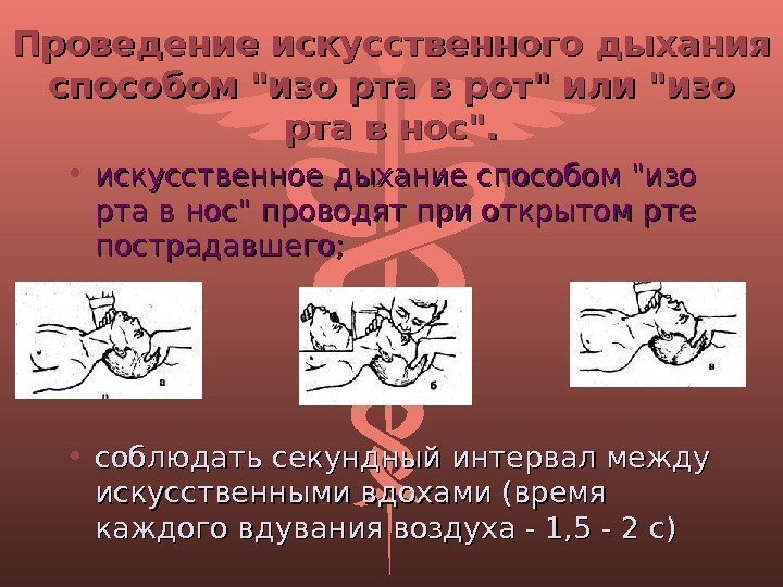 Проведение искусственного дыхания способом изо рта в рот или изо рта в нос. 