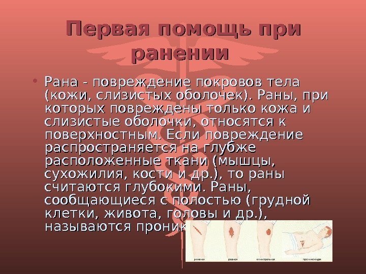 Первая помощь при ранении  • Рана - повреждение покровов тела (кожи, слизистых оболочек).