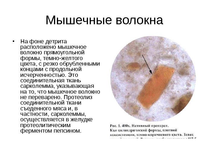 Мышечные волокна • На фоне детрита расположено мышечное волокно прямоугольной формы, темно-желтого цвета, с