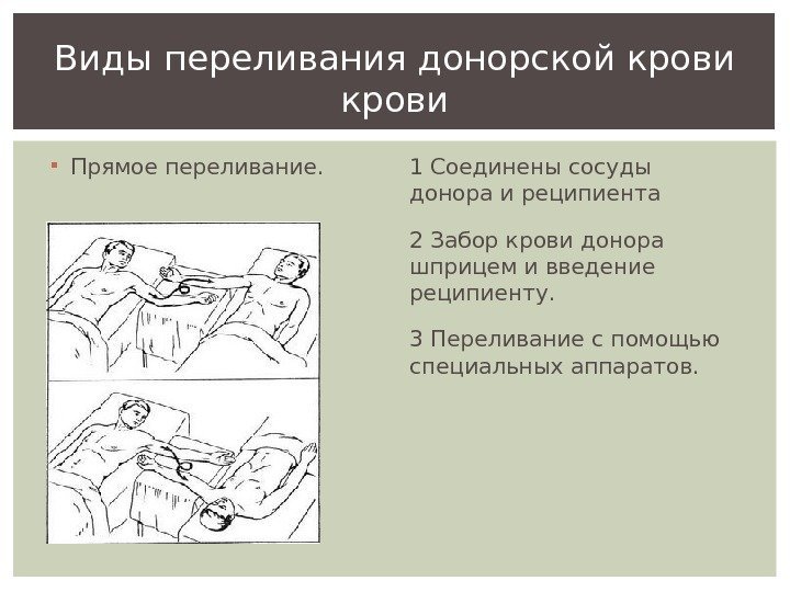  Прямое переливание.    1 Соединены сосуды донора и реципиента 2 Забор