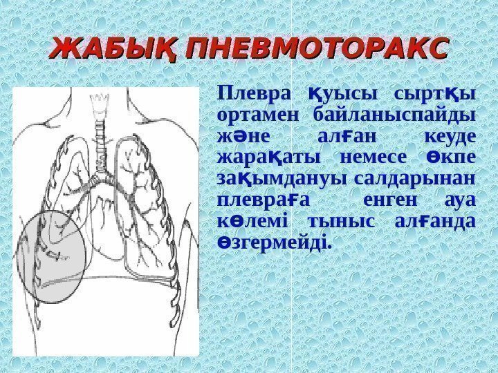 ЖАБЫҚ ПНЕВМОТОРАКС Плевра уысы сырт ы қ қ ортамен байланыспайды ж не ал ан