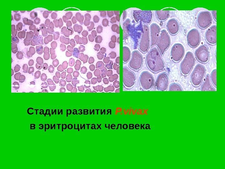   Стадии развития P. vivax  в эритроцитах человека 