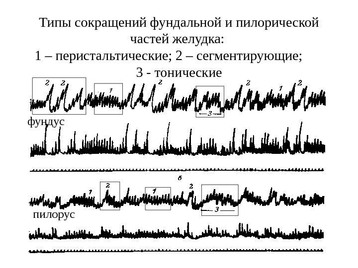 Типы сокращений фундальной и пилорической частей желудка:  1 – перистальтические; 2 – сегментирующие;