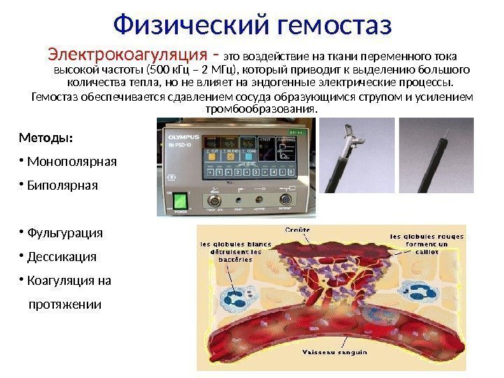 Физический гемостаз Электрокоагуляция - это воздействие на ткани переменного тока высокой частоты (500 к.