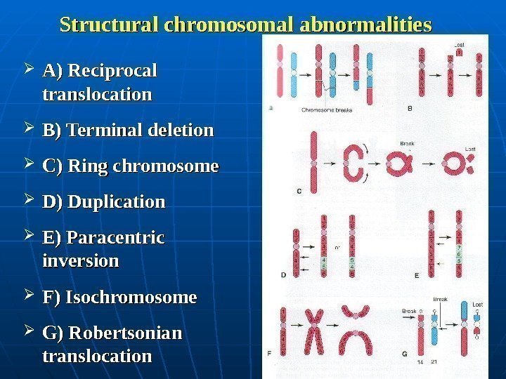  Structural chromosomal abnormalities A) Reciprocal translocation B) Terminal deletion C) Ring chromosome D)