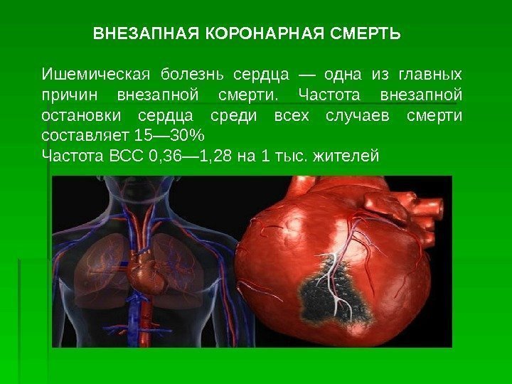 ВНЕЗАПНАЯ КОРОНАРНАЯ СМЕРТЬ Ишемическая болезнь сердца — одна из главных причин внезапной смерти. 