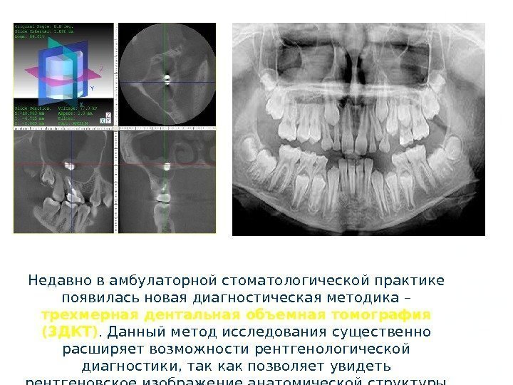 Недавно в амбулаторной стоматологической практике появилась новая диагностическая методика – трехмерная дентальная объемная томография