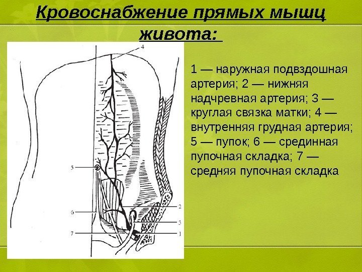 Кровоснабжение прямых мышц живота:  1 — наружная подвздошная артерия; 2 — нижняя надчревная