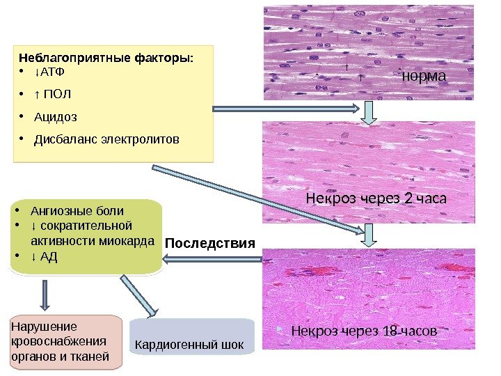   норма Некроз через 2 часа Некроз через 18 часов. Неблагоприятные факторы: 