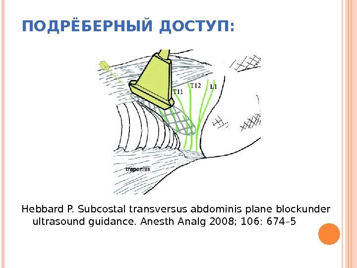 ПОДРЁБЕРНЫЙ ДОСТУП:      Hebbard P. Subcostal transversus abdominis plane blockunder