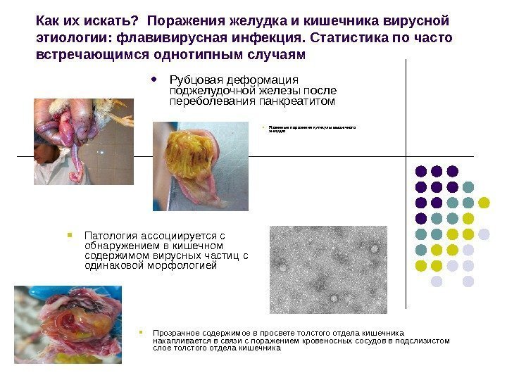 Как их искать?  Поражения желудка и кишечника вирусной этиологии: флавивирусная инфекция. Статистика по