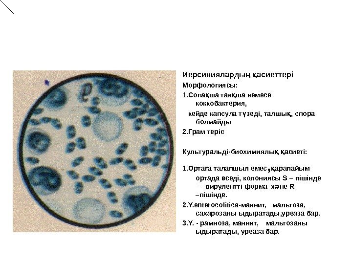 Иерсинияларды  асиеттерің қ Морфология сы :      1. Сопа