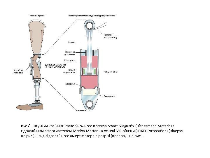 Рис. 8.  Штучний колінний суглоб ножного протеза Smart Magnetix ( Biedermann Motech )