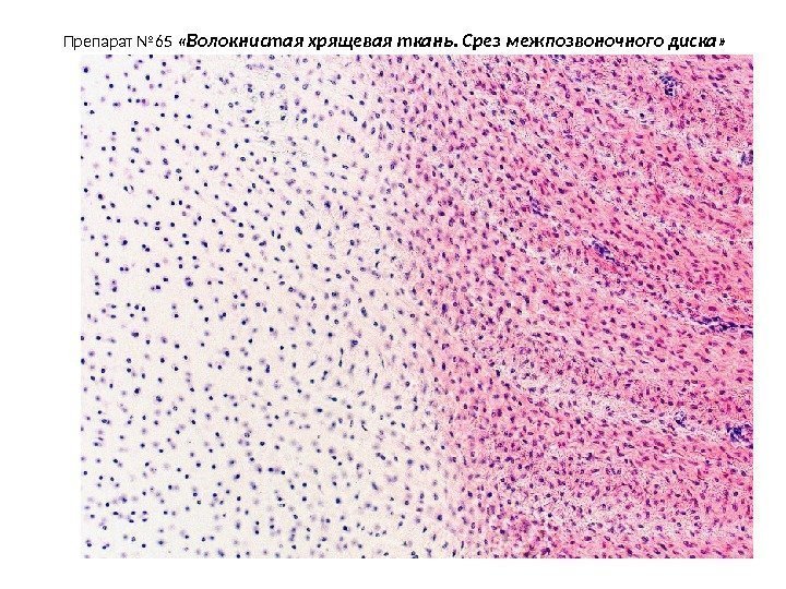 Препарат № 65  «Волокнистая хрящевая ткань. Срез межпозвоночного диска» 