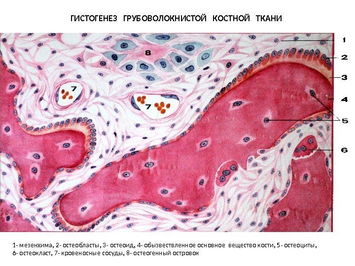 ГИСТОГЕНЕЗ  ГРУБОВОЛОКНИСТОЙ  КОСТНОЙ  ТКАНИ 1 - мезенхима, 2 - остеобласты, 3