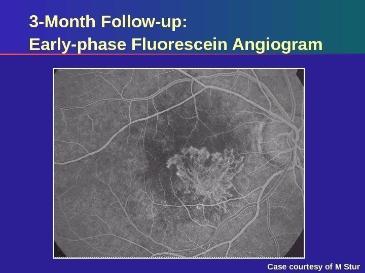 3 -Month Follow-up:  Early-phase Fluorescein Angiogram Case courtesy of M Stur 