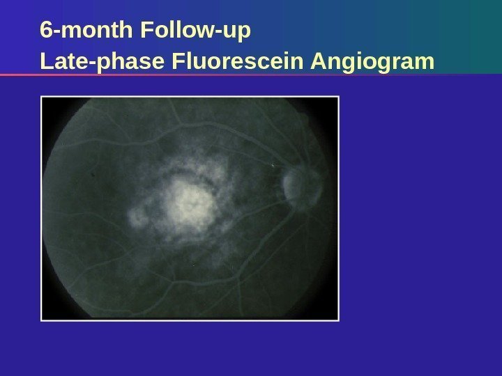 6 -month Follow-up Late-phase Fluorescein Angiogram 