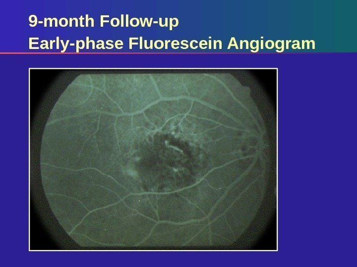 9 -month Follow-up Early-phase Fluorescein Angiogram 