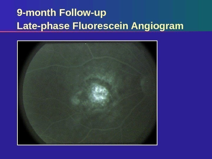 9 -month Follow-up Late-phase Fluorescein Angiogram 