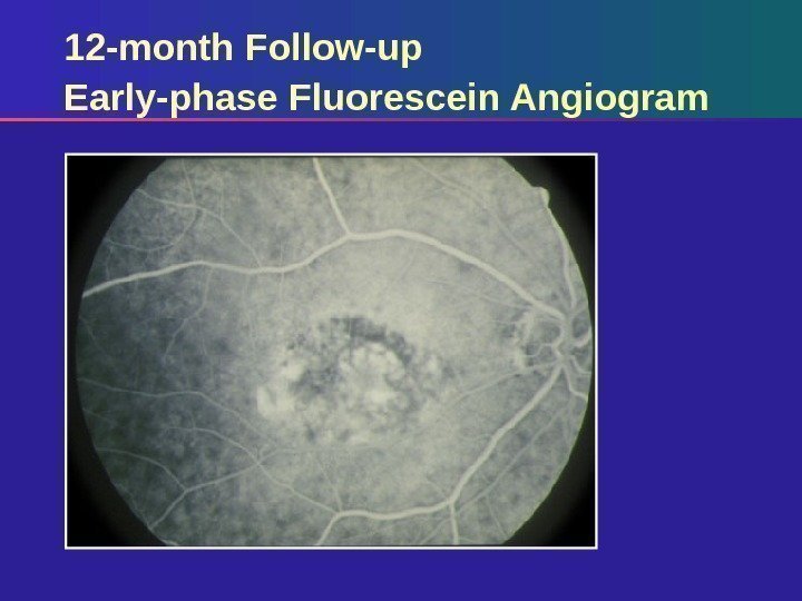 12 -month Follow-up Early-phase Fluorescein Angiogram 