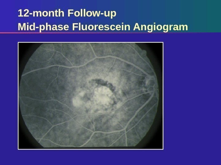 12 -month Follow-up Mid-phase Fluorescein Angiogram 