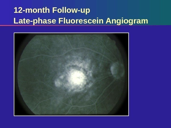 12 -month Follow-up Late-phase Fluorescein Angiogram 