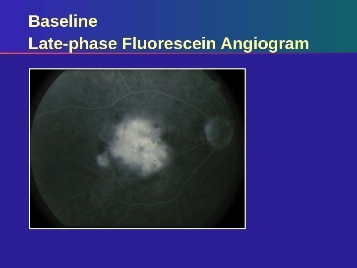 Baseline Late-phase Fluorescein Angiogram 