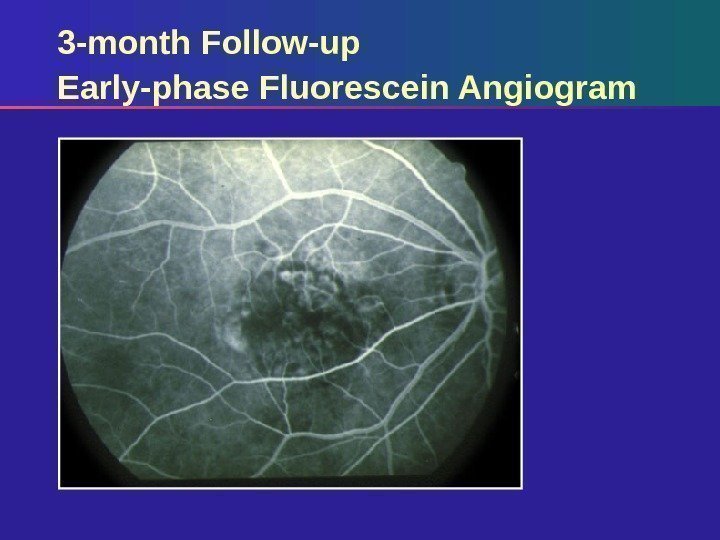 3 -month Follow-up Early-phase Fluorescein Angiogram 
