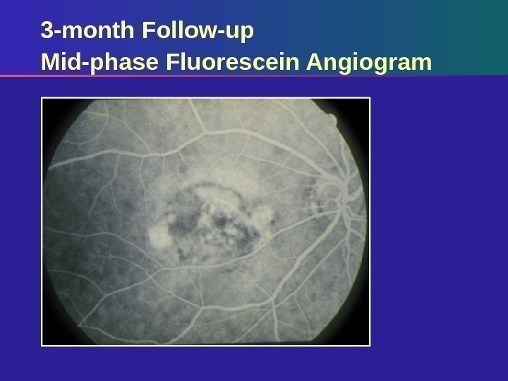 3 -month Follow-up Mid-phase Fluorescein Angiogram 