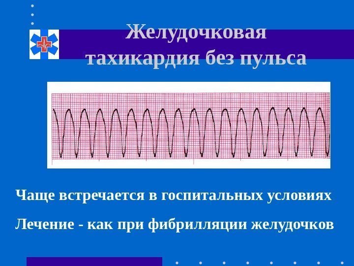 Желудочковая тахикардия без пульса Чаще встречается в госпитальных условиях Лечение - как при фибрилляции