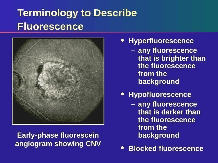 Terminology to Describe Fluorescence Hyperfluorescence – any fluorescence that is brighter than the fluorescence