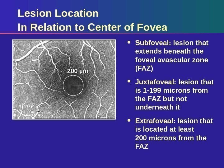 Lesion Location In Relation to Center of Fovea Subfoveal:  lesion that extends beneath
