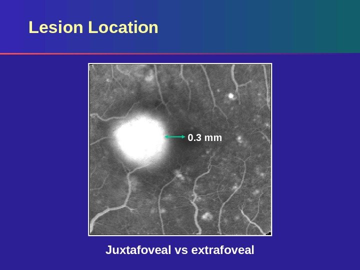 Lesion Location  0. 3 mm Juxtafoveal vs extrafoveal 
