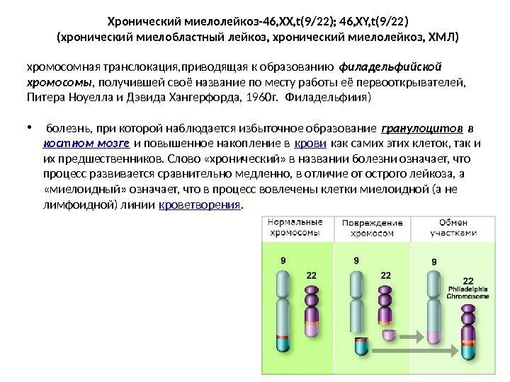 Хронический миелолейкоз-46, ХХ, t(9/22); 46, ХY, t(9/22) (хронический миелобластный лейкоз, хронический миелолейкоз, ХМЛ) хромосомная