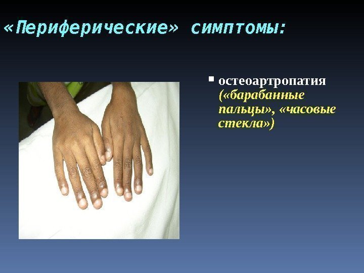  «Периферические» симптомы:  остеоартропатия ( «барабанные пальцы» ,  «часовые стекла» ) 