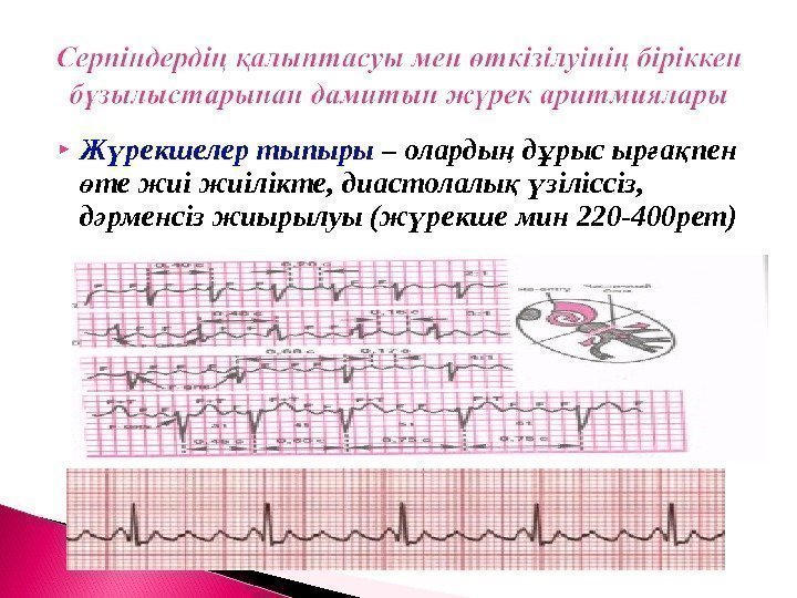  Ж рекшелер тыпырыү – оларды д рыс ыр а пен ң ұ ғ