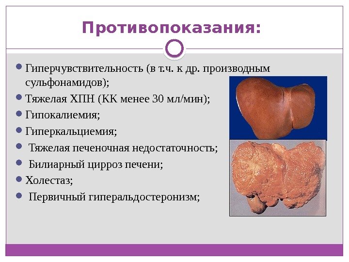 Противопоказания:  Гиперчувствительность (в т. ч. к др. производным сульфонамидов);  Тяжелая ХПН (КК