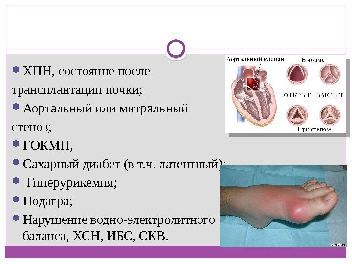  ХПН, состояние после трансплантации почки;  Аортальный или митральный стеноз;  ГОКМП, 