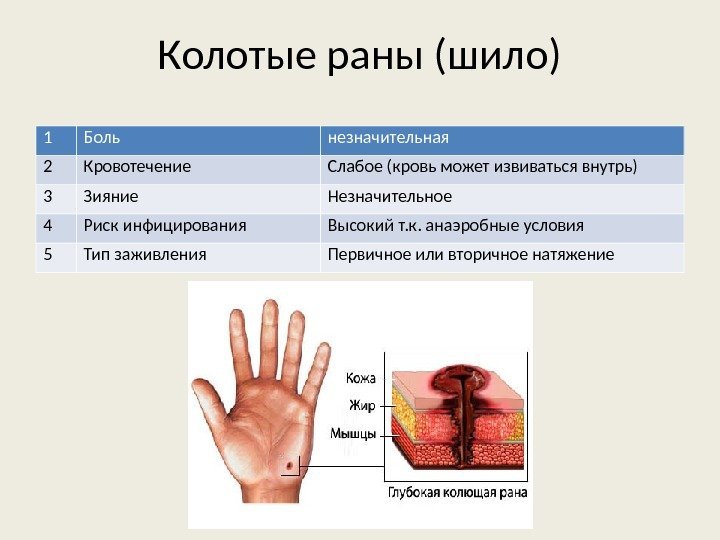 Колотые раны (шило) 1 Боль незначительная 2 Кровотечение Слабое (кровь может извиваться внутрь) 3