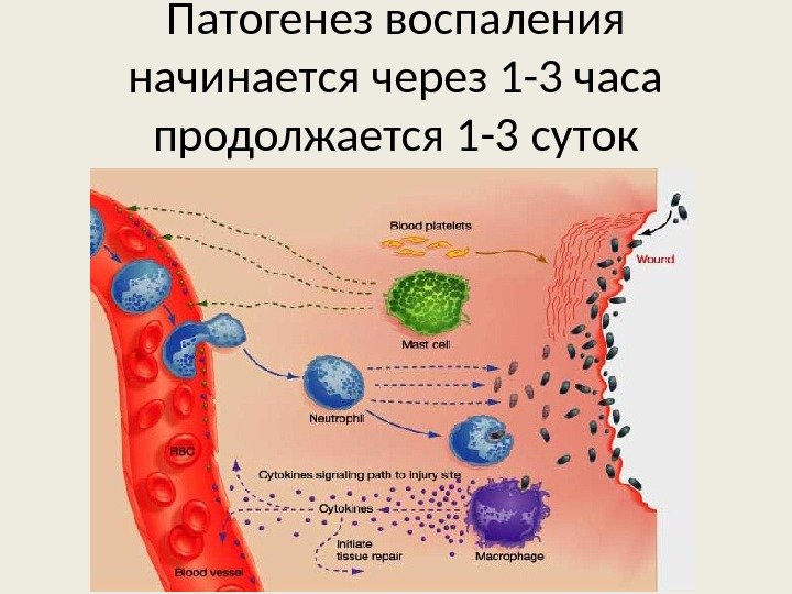 Патогенез воспаления начинается через 1 -3 часа продолжается 1 -3 суток 