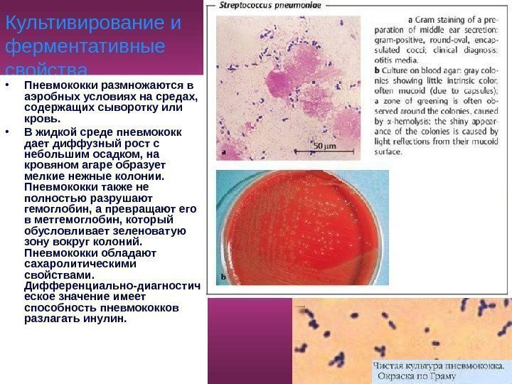   Культивирование и ферментативные свойства • Пневмококки размножаются в аэробных условиях на средах,