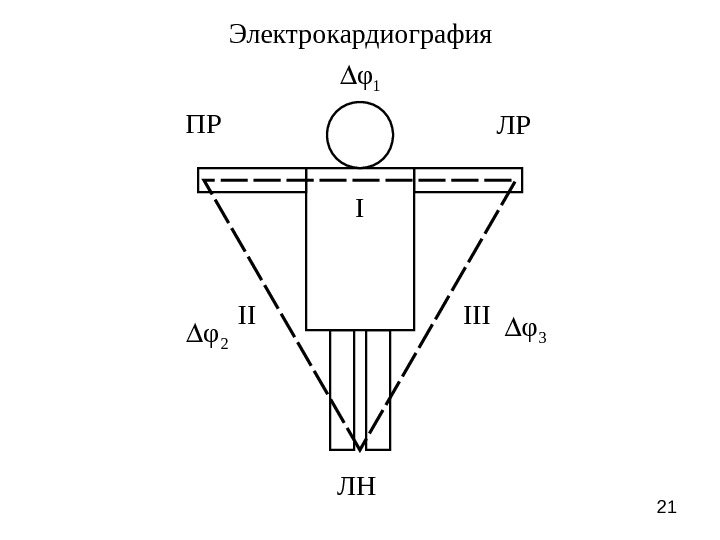 21 ПР ЛР I ЛНII IIIЭлектрокардиография 1φ 2φ 3 φ 