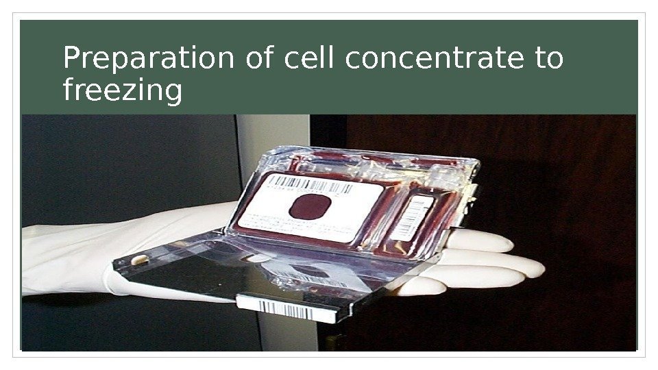 Preparation of cell concentrate to freezing 