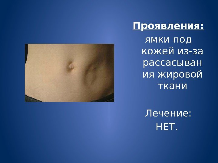 Проявления: ямки под кожей из-за рассасыван ия жировой ткани Лечение: НЕТ.  