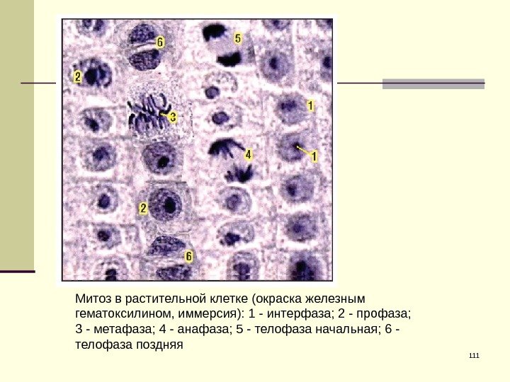 111 Митоз в растительной клетке (окраска железным гематоксилином, иммерсия): 1 - интерфаза; 2 -